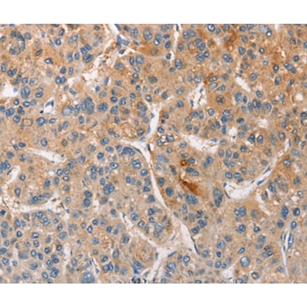 Immunohistochemistry - CCL4 Antibody from Signalway Antibody (35672) - Antibodies.com