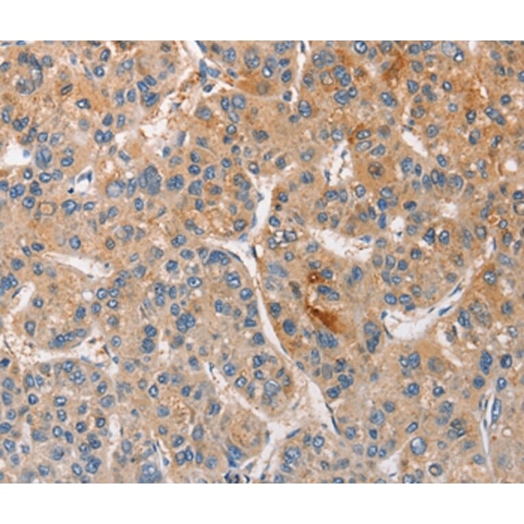 Immunohistochemistry - CCL4 Antibody from Signalway Antibody (35672) - Antibodies.com
