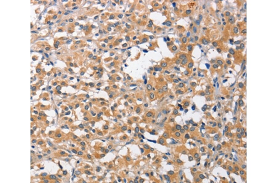 Immunohistochemistry - CCL4 Antibody from Signalway Antibody (35672) - Antibodies.com