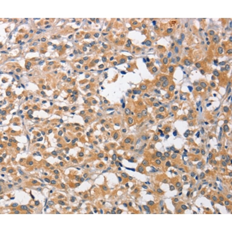 Immunohistochemistry - CCL4 Antibody from Signalway Antibody (35672) - Antibodies.com