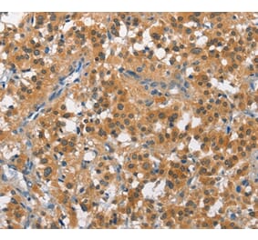 Immunohistochemistry - CUL7 Antibody from Signalway Antibody (35699) - Antibodies.com