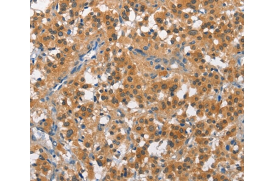 Immunohistochemistry - CUL7 Antibody from Signalway Antibody (35699) - Antibodies.com