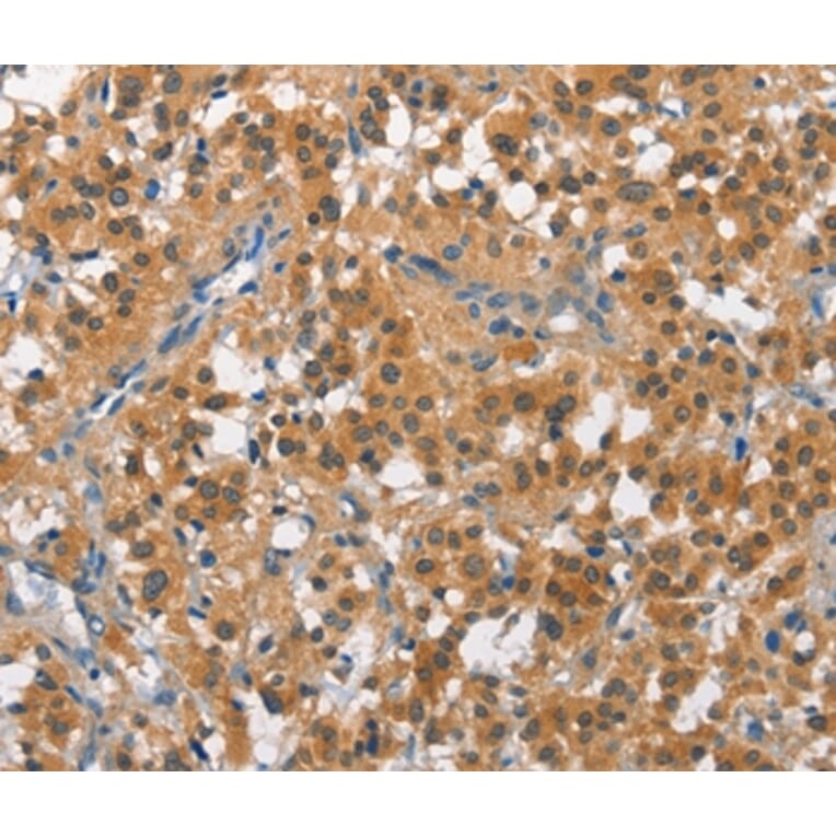Immunohistochemistry - CUL7 Antibody from Signalway Antibody (35699) - Antibodies.com