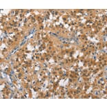 Immunohistochemistry - CUL7 Antibody from Signalway Antibody (35699) - Antibodies.com