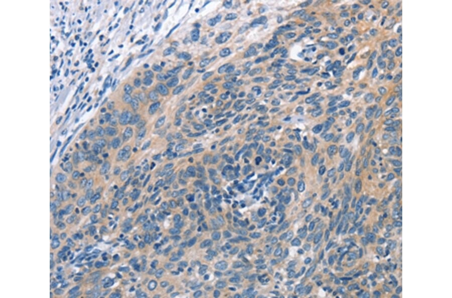 Immunohistochemistry - CUL7 Antibody from Signalway Antibody (35699) - Antibodies.com