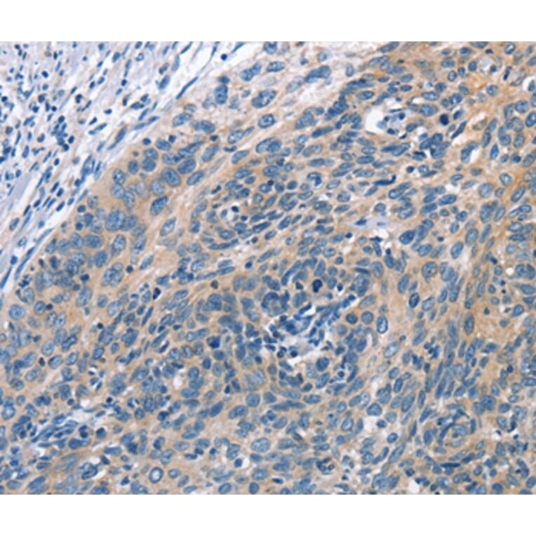 Immunohistochemistry - CUL7 Antibody from Signalway Antibody (35699) - Antibodies.com