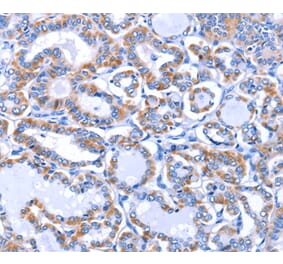 Immunohistochemistry - GJB3 Antibody from Signalway Antibody (35700) - Antibodies.com