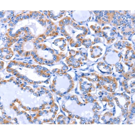 Immunohistochemistry - GJB3 Antibody from Signalway Antibody (35700) - Antibodies.com