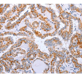 Immunohistochemistry - DTX2 Antibody from Signalway Antibody (35711) - Antibodies.com