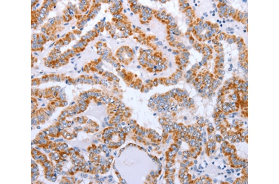Immunohistochemistry - DTX2 Antibody from Signalway Antibody (35711) - Antibodies.com