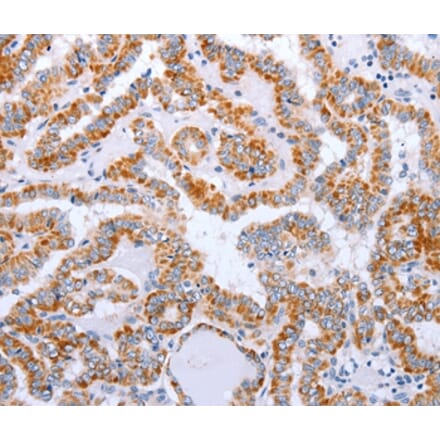 Immunohistochemistry - DTX2 Antibody from Signalway Antibody (35711) - Antibodies.com