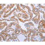 Immunohistochemistry - DTX2 Antibody from Signalway Antibody (35711) - Antibodies.com