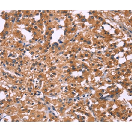 Immunohistochemistry - DKK4 Antibody from Signalway Antibody (35713) - Antibodies.com