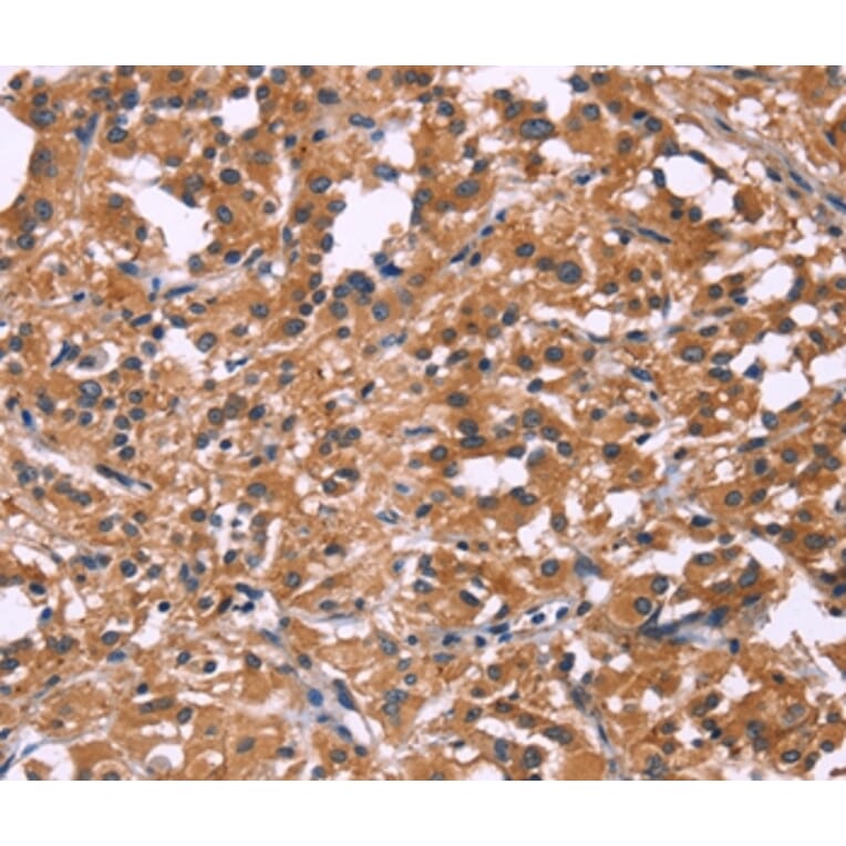 Immunohistochemistry - DKK4 Antibody from Signalway Antibody (35713) - Antibodies.com
