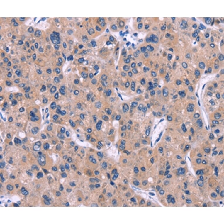 Immunohistochemistry - DKK4 Antibody from Signalway Antibody (35713) - Antibodies.com