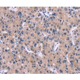 Immunohistochemistry - DKK4 Antibody from Signalway Antibody (35713) - Antibodies.com
