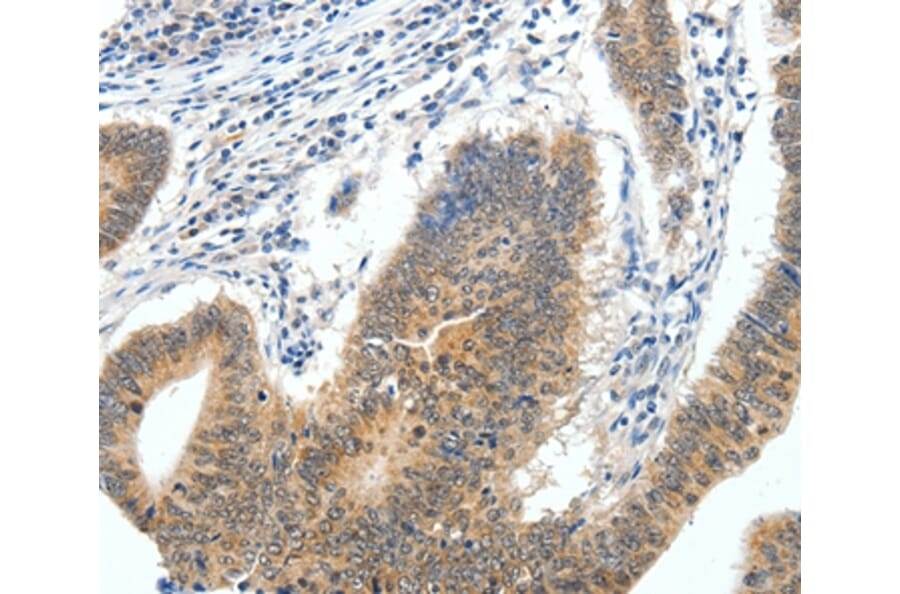 Immunohistochemistry - ECE2 Antibody from Signalway Antibody (35719) - Antibodies.com