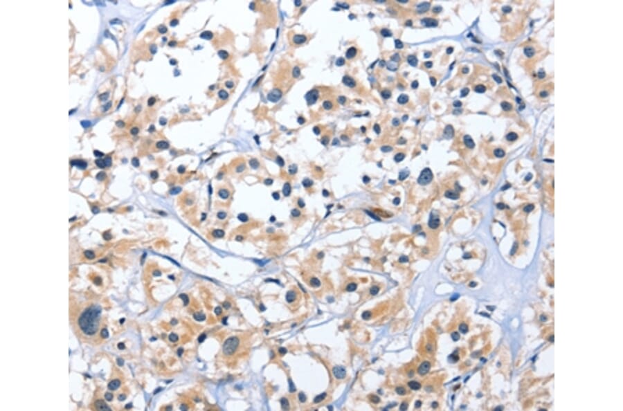 Immunohistochemistry - EDN3 Antibody from Signalway Antibody (35733) - Antibodies.com