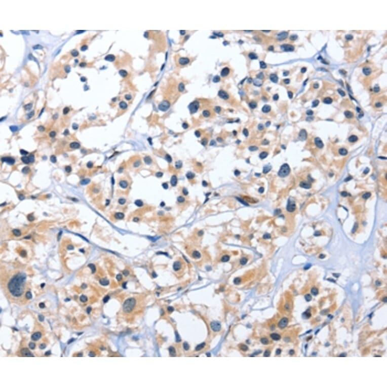 Immunohistochemistry - EDN3 Antibody from Signalway Antibody (35733) - Antibodies.com