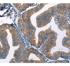 Immunohistochemistry - EDN2 Antibody from Signalway Antibody (35734) - Antibodies.com