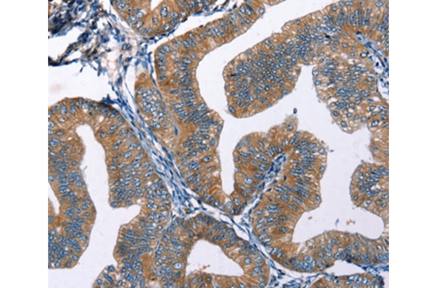 Immunohistochemistry - EDN2 Antibody from Signalway Antibody (35734) - Antibodies.com
