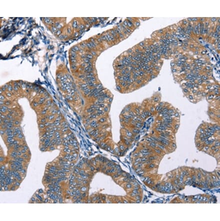 Immunohistochemistry - EDN2 Antibody from Signalway Antibody (35734) - Antibodies.com