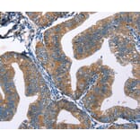 Immunohistochemistry - EDN2 Antibody from Signalway Antibody (35734) - Antibodies.com