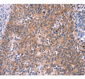 Immunohistochemistry - EDN1 Antibody from Signalway Antibody (35735) - Antibodies.com