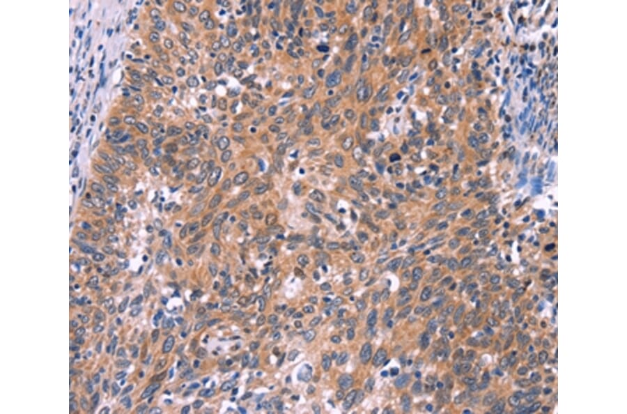 Immunohistochemistry - EDN1 Antibody from Signalway Antibody (35735) - Antibodies.com