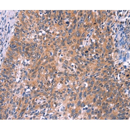 Immunohistochemistry - EDN1 Antibody from Signalway Antibody (35735) - Antibodies.com