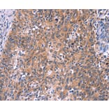 Immunohistochemistry - EDN1 Antibody from Signalway Antibody (35735) - Antibodies.com