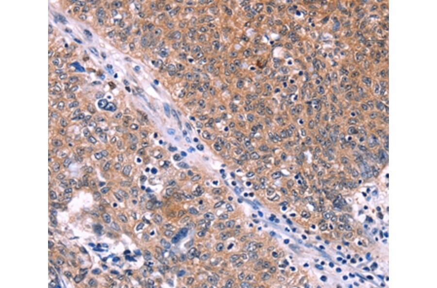 Immunohistochemistry - EDN1 Antibody from Signalway Antibody (35735) - Antibodies.com