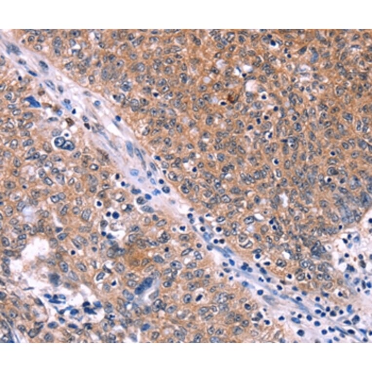 Immunohistochemistry - EDN1 Antibody from Signalway Antibody (35735) - Antibodies.com