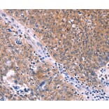 Immunohistochemistry - EDN1 Antibody from Signalway Antibody (35735) - Antibodies.com