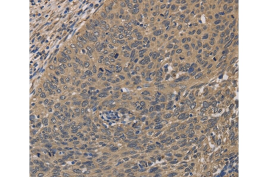Immunohistochemistry - HSF1 Antibody from Signalway Antibody (35770) - Antibodies.com