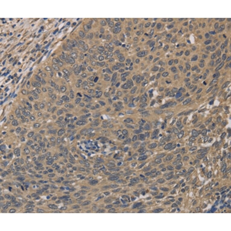 Immunohistochemistry - HSF1 Antibody from Signalway Antibody (35770) - Antibodies.com