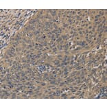 Immunohistochemistry - HSF1 Antibody from Signalway Antibody (35770) - Antibodies.com