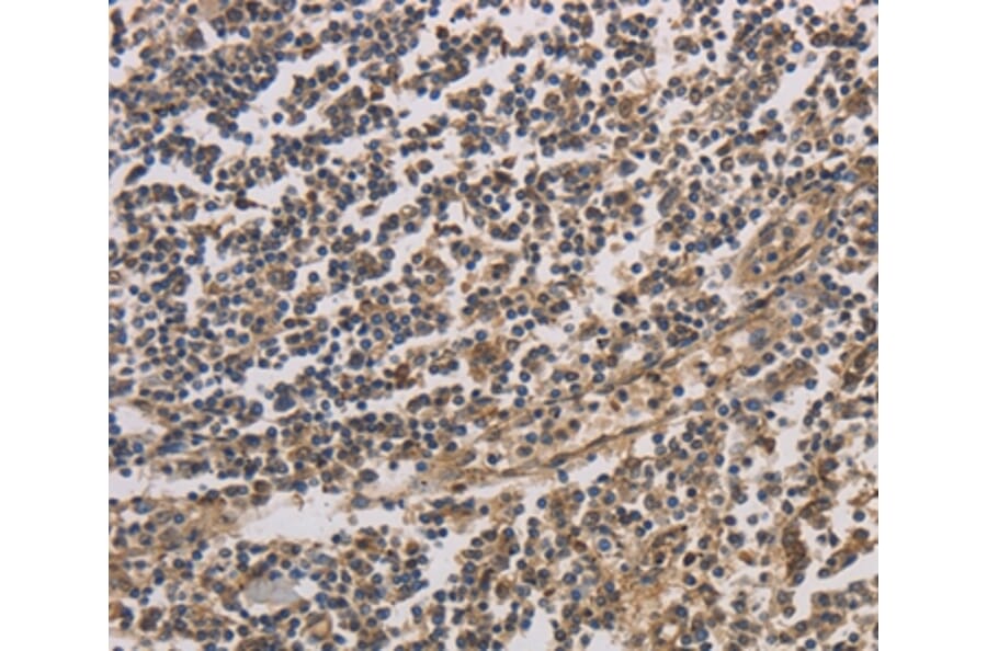 Immunohistochemistry - HSF1 Antibody from Signalway Antibody (35770) - Antibodies.com