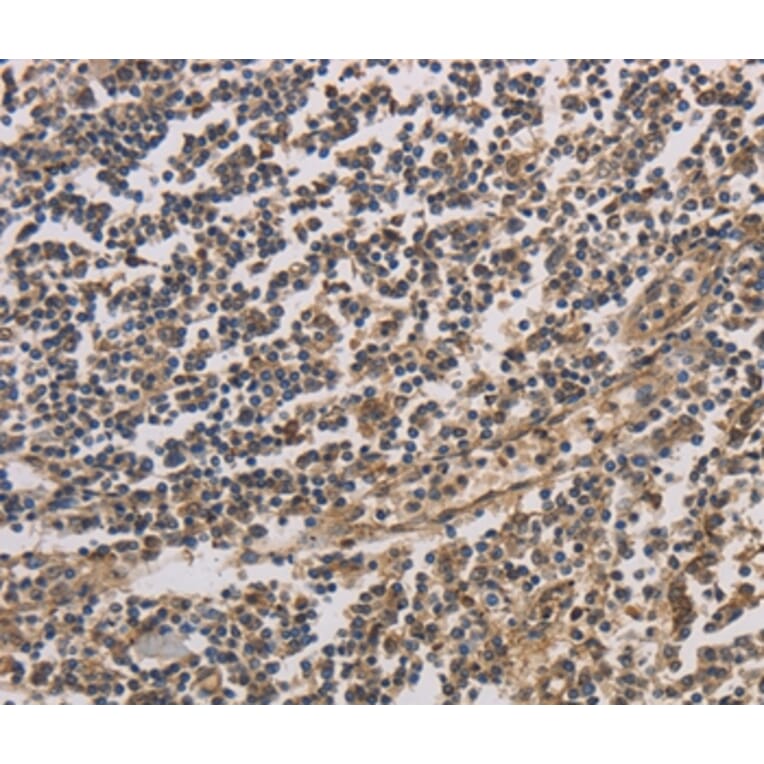 Immunohistochemistry - HSF1 Antibody from Signalway Antibody (35770) - Antibodies.com