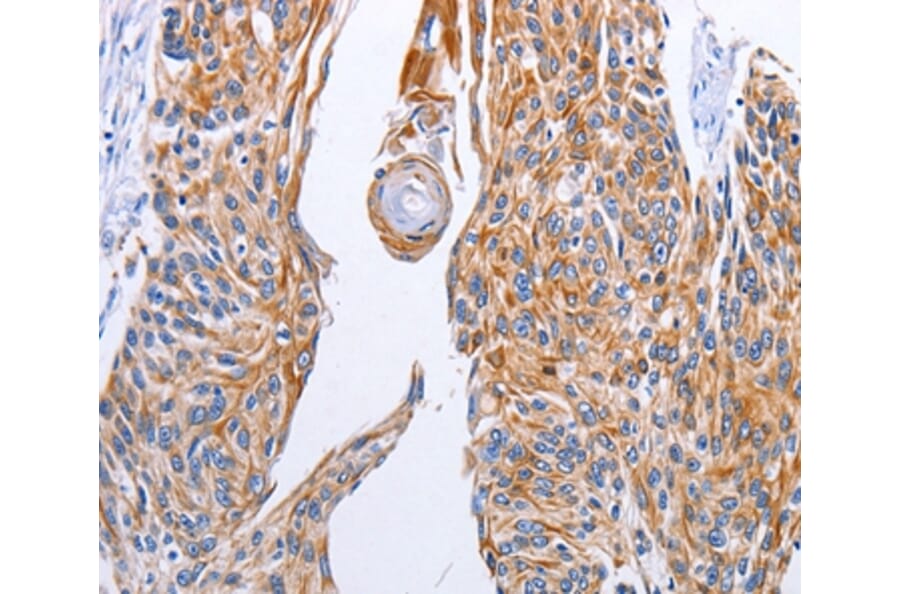 Immunohistochemistry - LIPE Antibody from Signalway Antibody (35771) - Antibodies.com