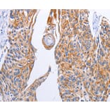 Immunohistochemistry - LIPE Antibody from Signalway Antibody (35771) - Antibodies.com