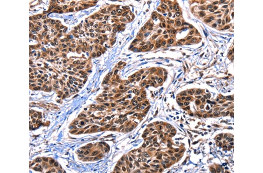 Immunohistochemistry - DFFA Antibody from Signalway Antibody (35774) - Antibodies.com