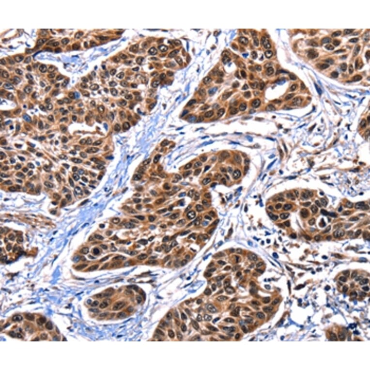 Immunohistochemistry - DFFA Antibody from Signalway Antibody (35774) - Antibodies.com