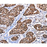 Immunohistochemistry - DFFA Antibody from Signalway Antibody (35774) - Antibodies.com
