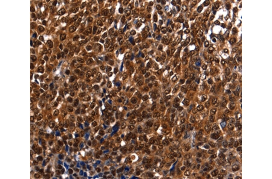 Immunohistochemistry - DFFA Antibody from Signalway Antibody (35774) - Antibodies.com