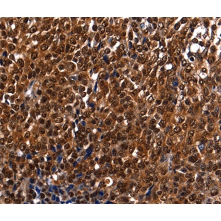 Immunohistochemistry - DFFA Antibody from Signalway Antibody (35774) - Antibodies.com