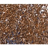 Immunohistochemistry - DFFA Antibody from Signalway Antibody (35774) - Antibodies.com