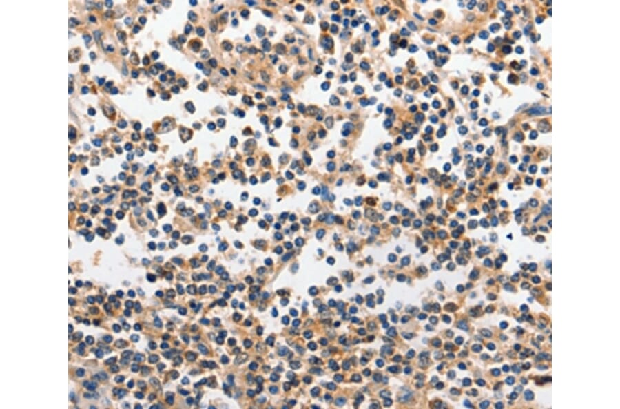 Immunohistochemistry - INHA Antibody from Signalway Antibody (35780) - Antibodies.com