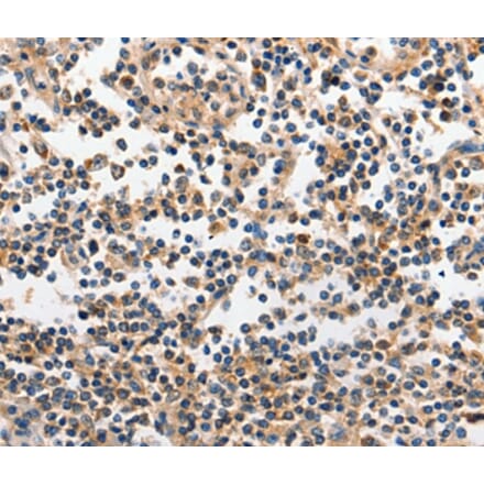 Immunohistochemistry - INHA Antibody from Signalway Antibody (35780) - Antibodies.com
