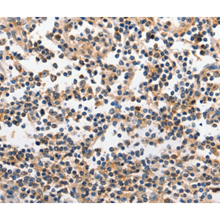 Immunohistochemistry - INHA Antibody from Signalway Antibody (35780) - Antibodies.com